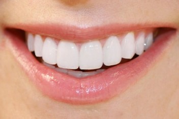 لبخندی زیبا  با دندان های سفید