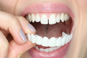 ارزان ترین دندانپزشکی برای لمینیت دندان