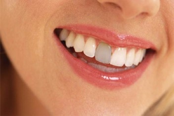علائم بیماری غیر دندانی و تاثیر آن بر دندان
